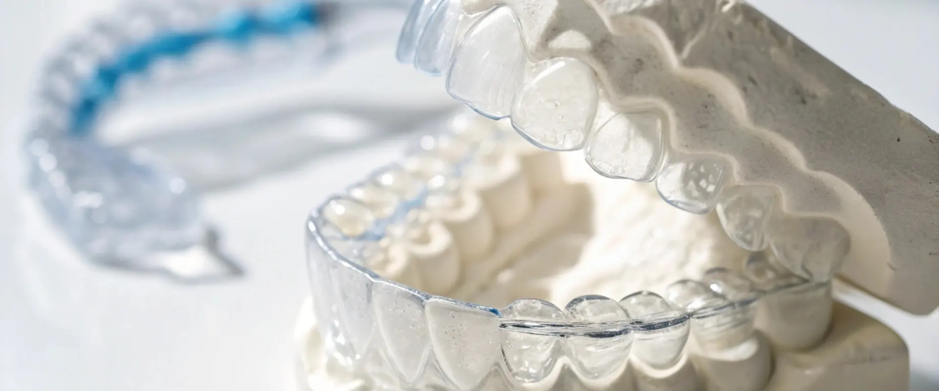 Errores comunes con alineadores invisibles y cómo evitarlos